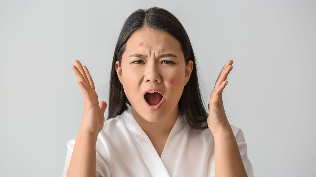 Why is my acne NOT getting better? 5 possible reasons and solutions