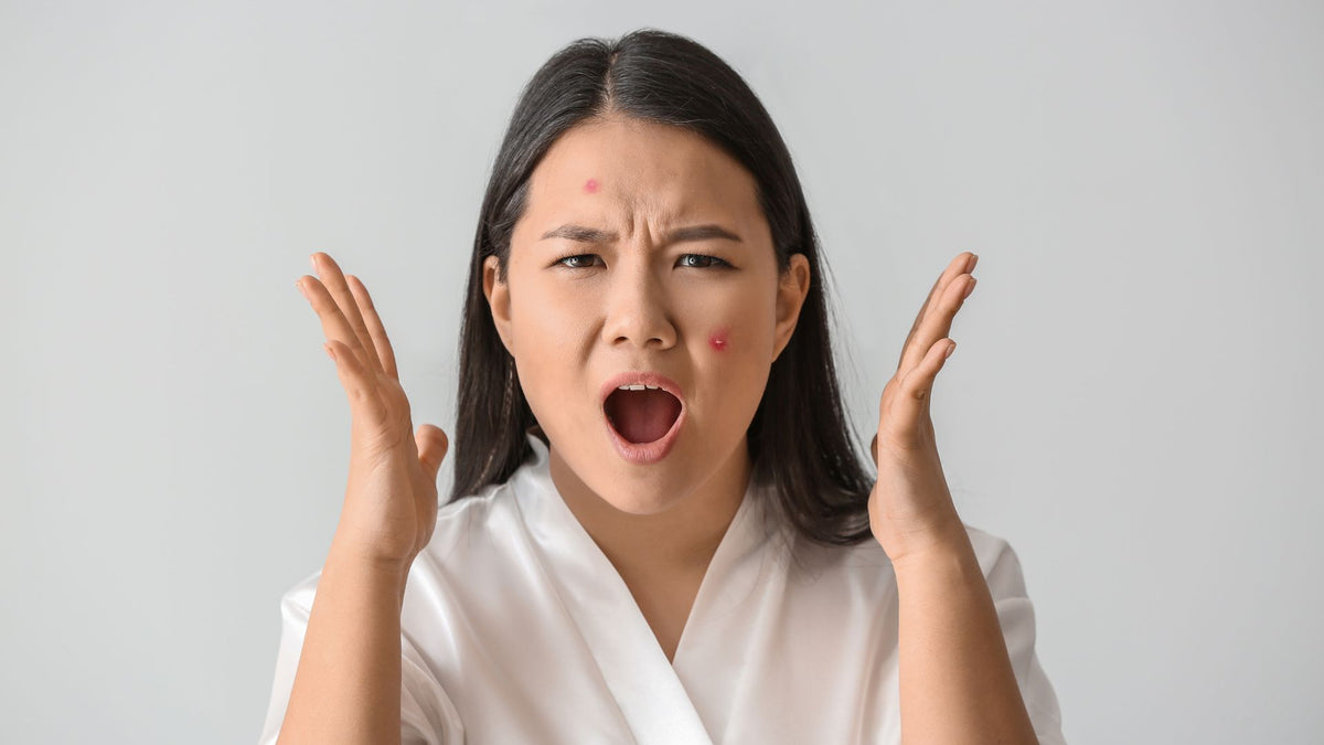 Why is my acne NOT getting better? 5 possible reasons and solutions