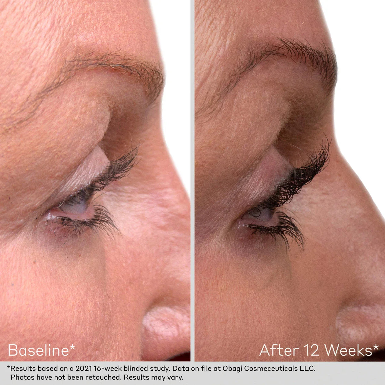 Obagi Nu-Cil Lash and Brow Serum Set