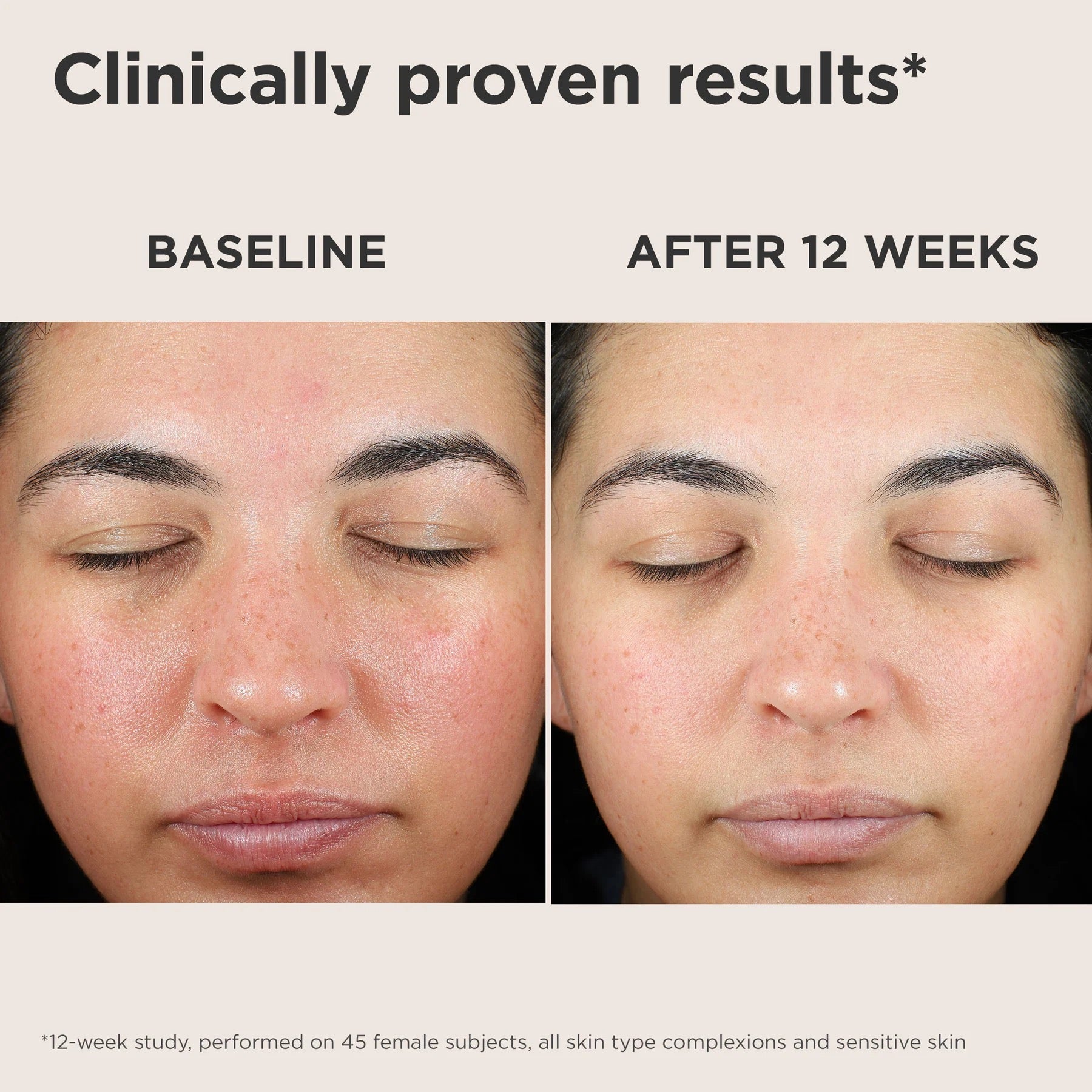 EltaMD UV Skin Recovery Red Color Correcting Green Tint