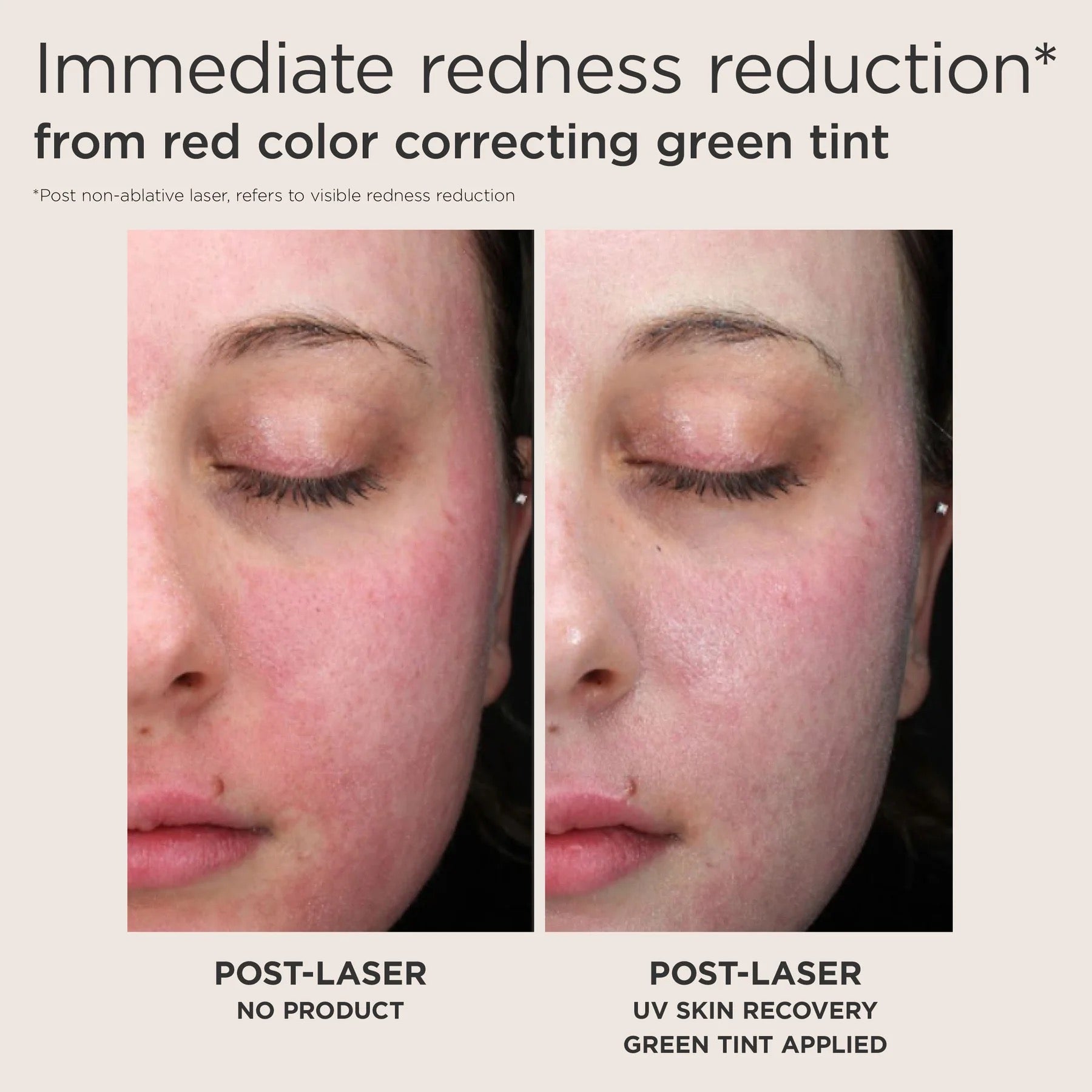 EltaMD UV Skin Recovery Red Color Correcting Green Tint